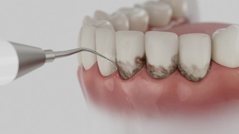 Trusted Emergency Dentist service in Elmo, TX - Dentist Open Now
